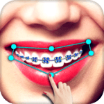 Braces APK Braces APK