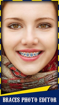 Braces for PC screenshot 1