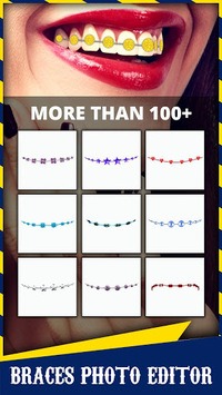 Braces for PC screenshot 2