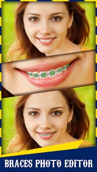 Braces for PC screenshot 3