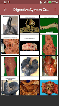 Pathology Atlas (Basic Gross & Microscopic slides) for PC screenshot 1