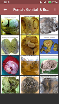 Pathology Atlas (Basic Gross & Microscopic slides) for PC screenshot 2