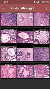 Pathology Atlas (Basic Gross & Microscopic slides) for PC screenshot 3