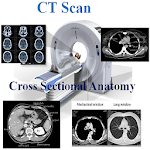 CT Scan Cross Sectional Anatomy APK
