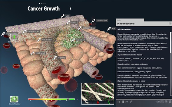 bodyxq cancer for PC screenshot 1