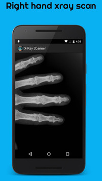 X-Ray  Scanner Prank-Camera Body Scanner Simulator for PC screenshot 2