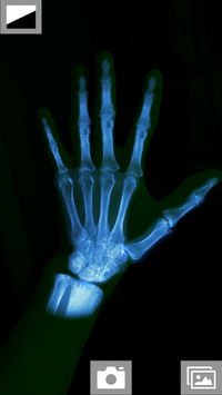 Super XRay Camera for PC screenshot 2