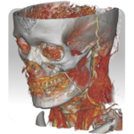 DroidRender - 3D DICOM viewer APK