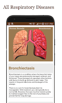 All Respiratory Disease and Treatment for PC screenshot 3